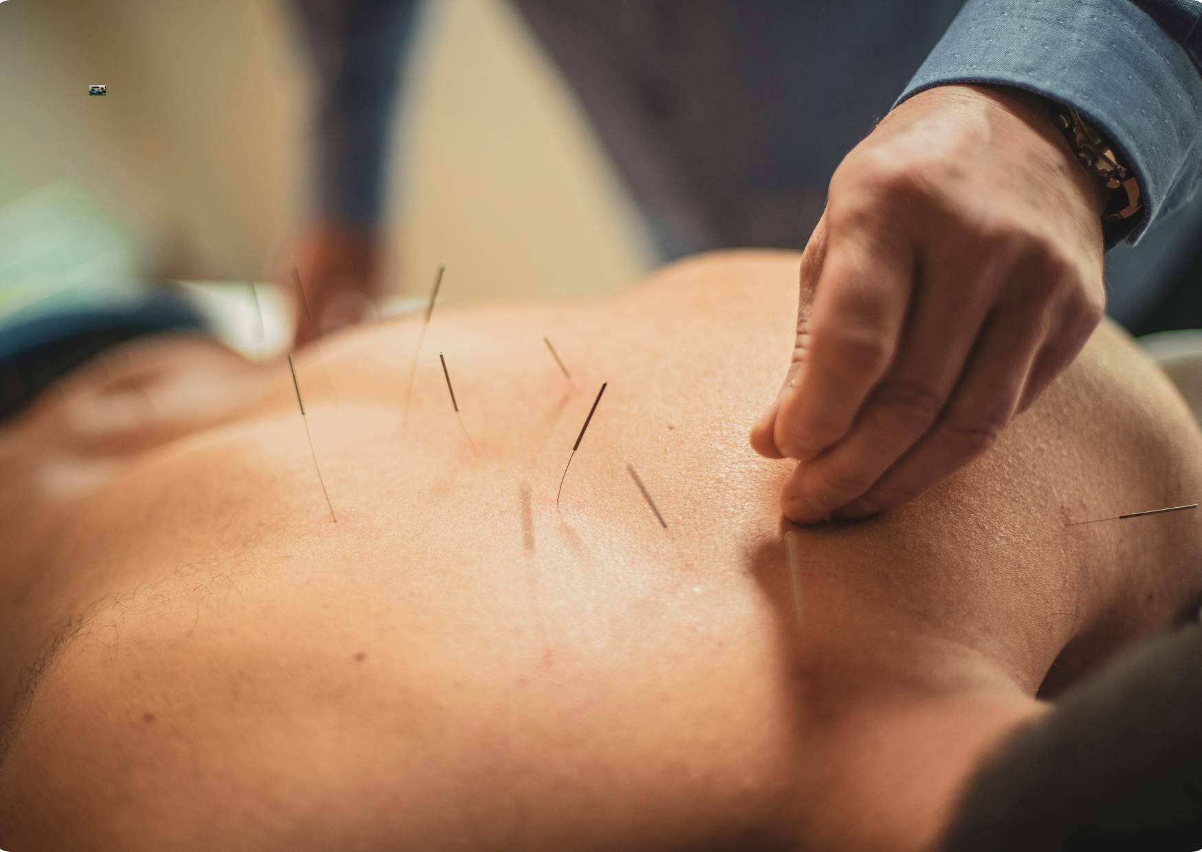 Acupuncture Online Training